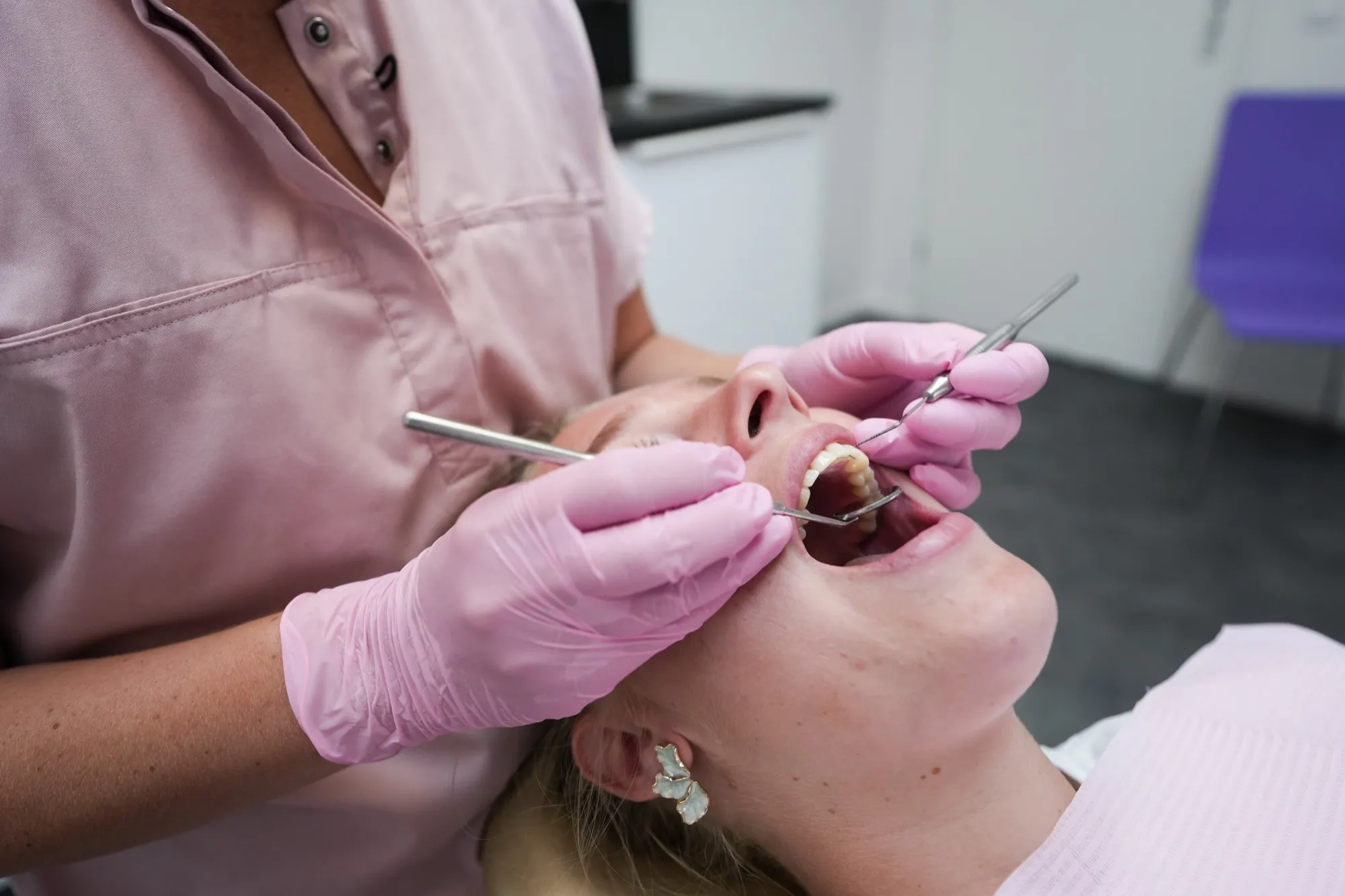 Professionele gebitsreiniging bij Tosk Mondzorg